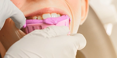 Poly Vinyl Siloxane
